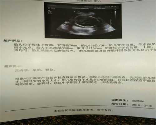  广州中国代孕公司_【南方IVF】_精子在体外存活时间？